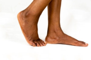 Dealing With Flat Feet